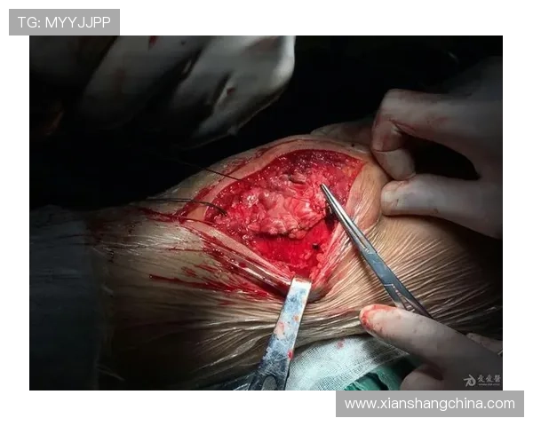 万幸！髌腱撕裂手术可恢复膝关节